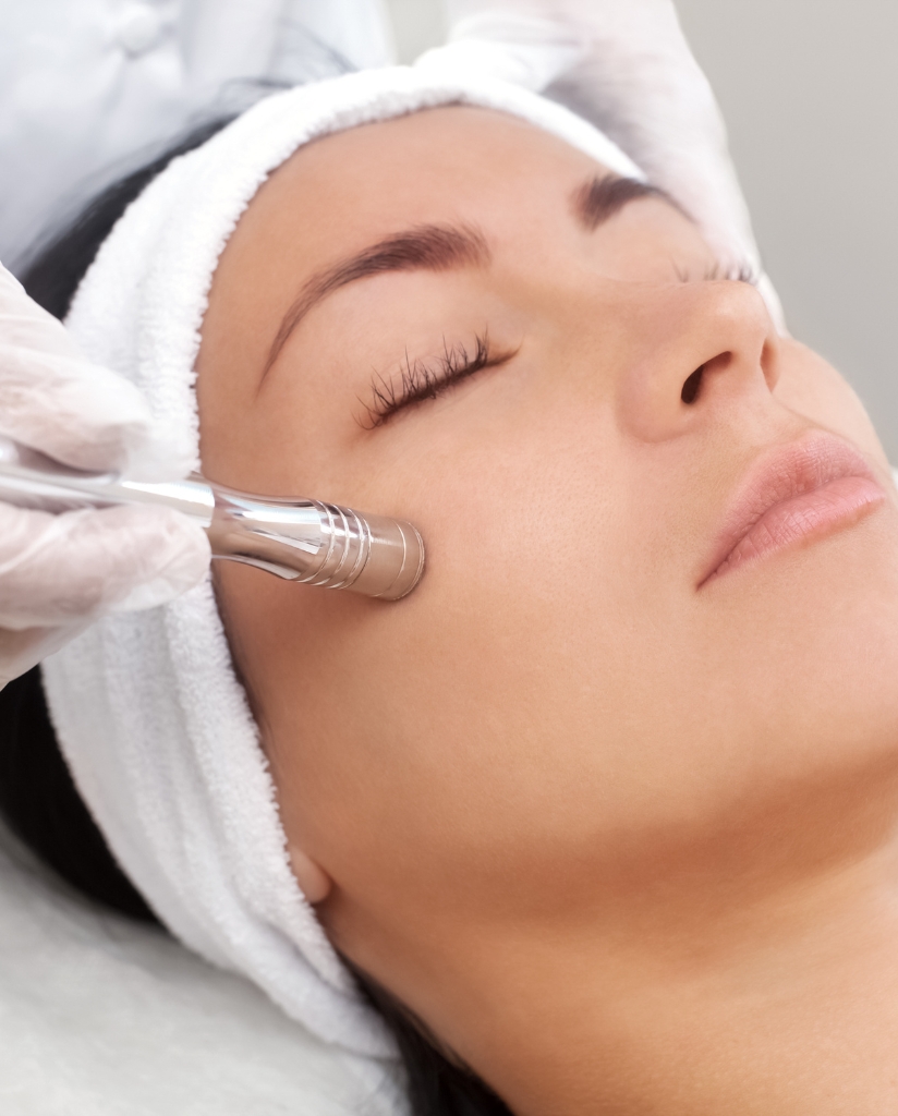 Microdermabrasion