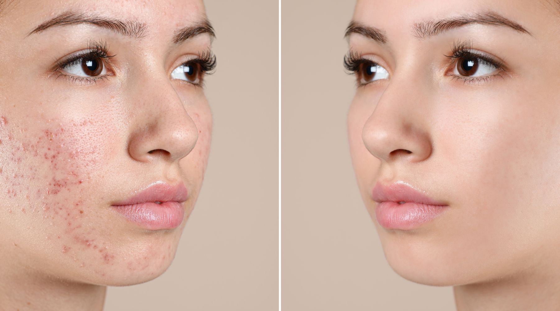 Skin treatments Adelaide