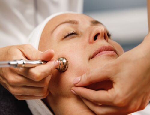 Microdermabrasion Adelaide: Revitalise Your Skin