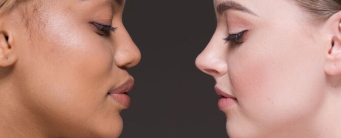 Facial slimming