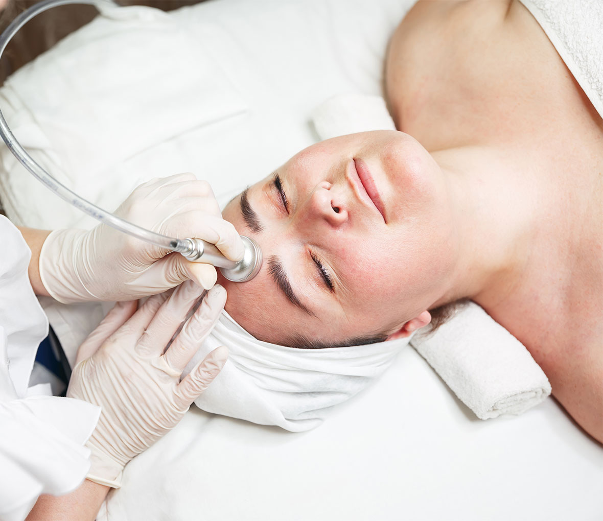 Microdermabrasion Adelaide