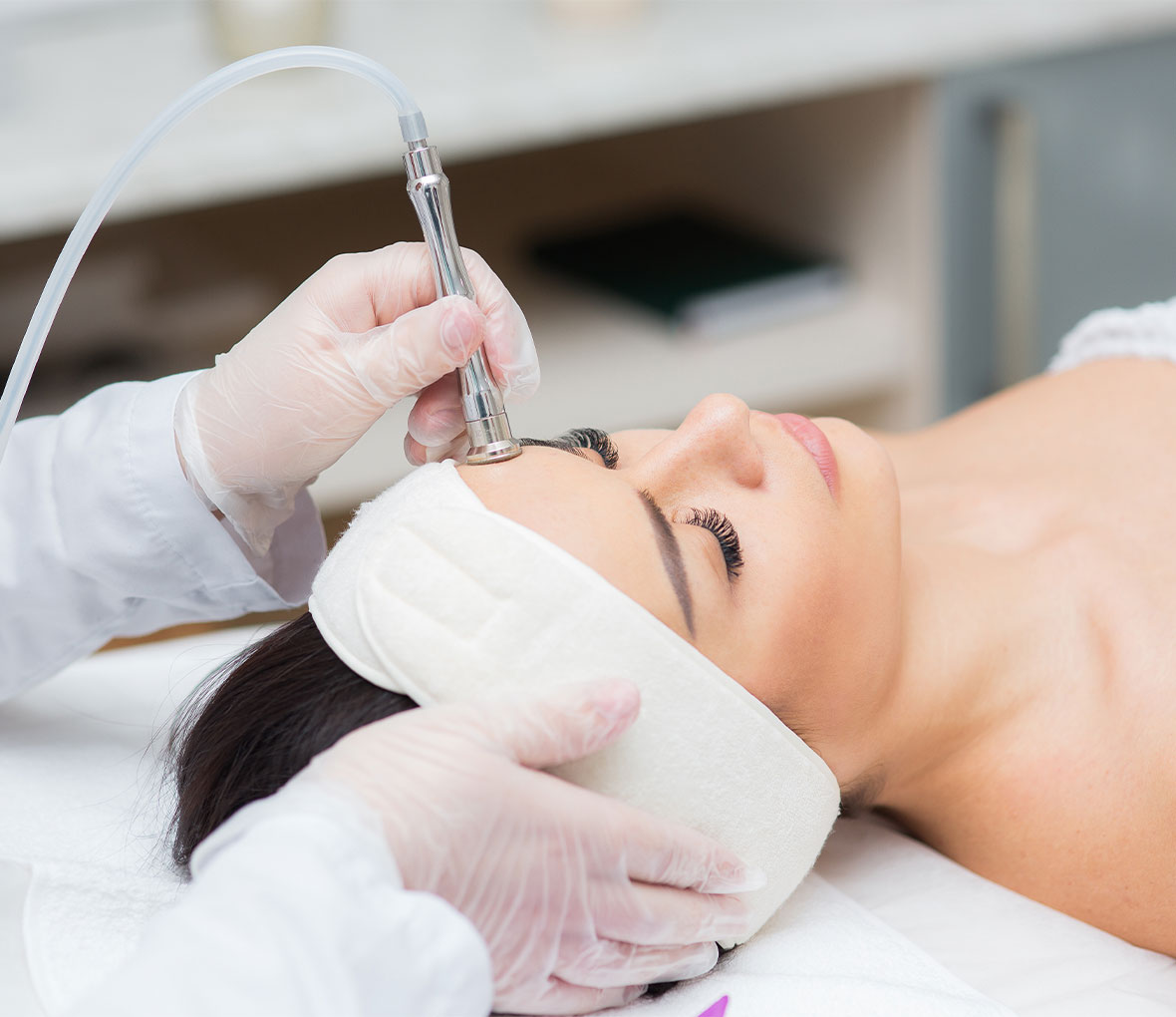 Microdermabrasion Adelaide