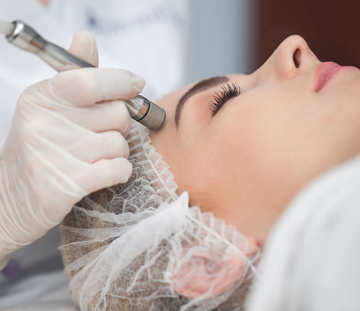 Microdermabrasion Adelaide