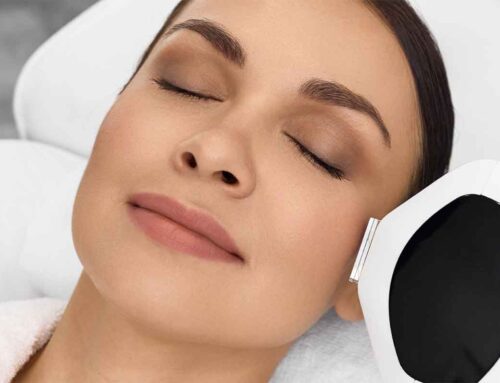 IPL Skin Treatment in Adelaide: Procedure Guide