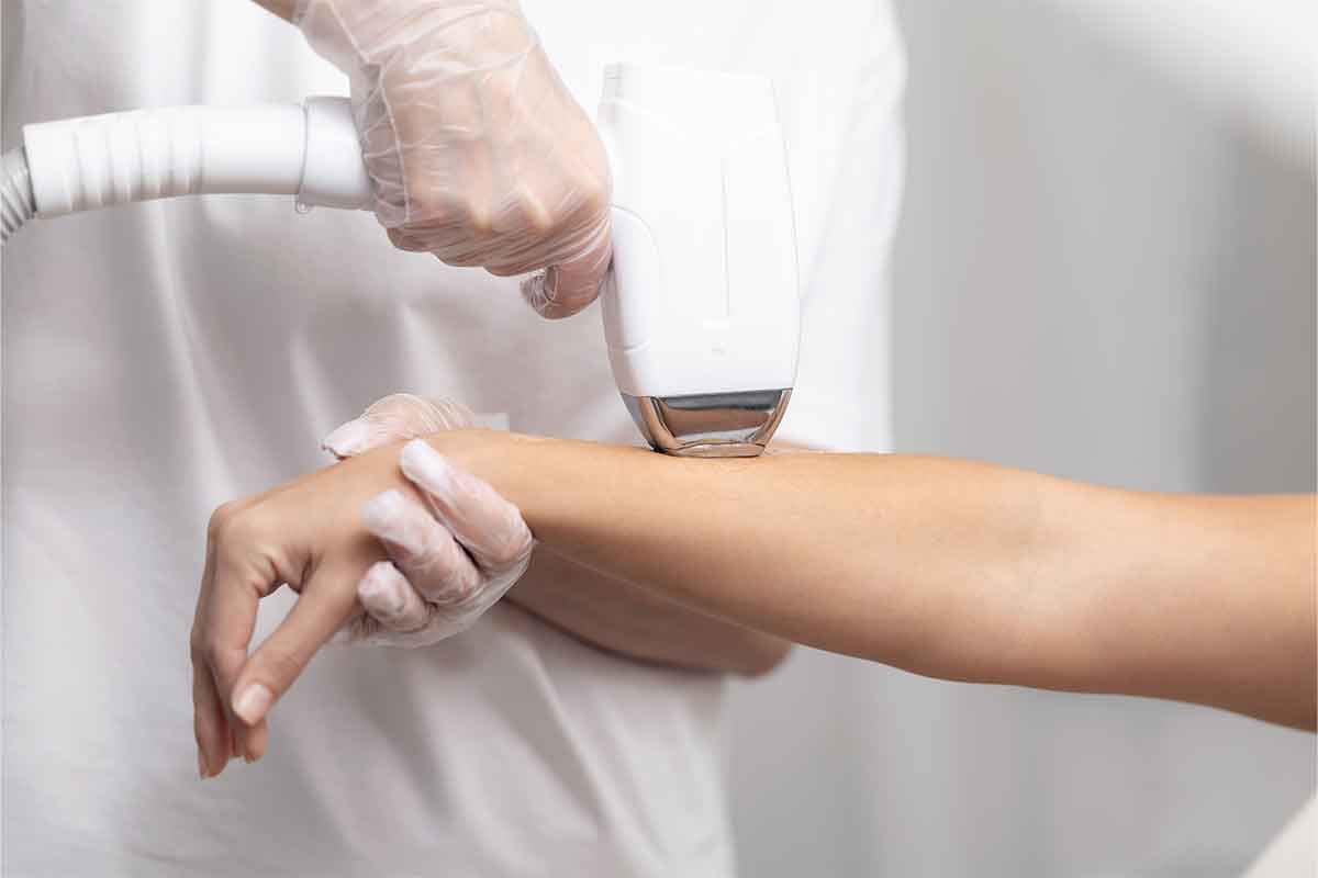 Laser care in Australia, Aesthetic Nurse Suzie, Adelaide