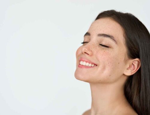 Skin Whitening Treatment Adelaide: Clinical Facts