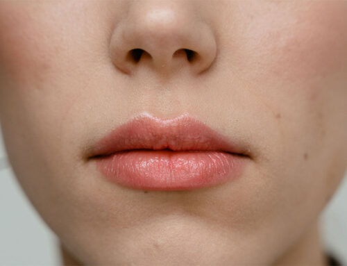 Lip Hydration Treatment vs Fillers Explained